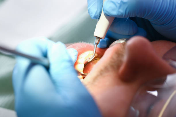 Best Pediatric Emergency Dentist in Matthews, NC